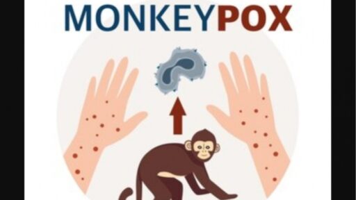 Monkeypox Penyakit Apa? Kenali Ancaman Kesehatan yang Menyerang Kulit Anda!