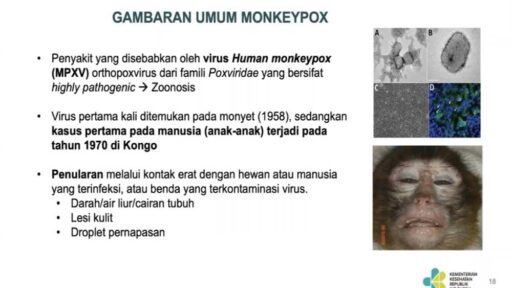 Pasien Mpox di Kongo Timur Terjebak Kekurangan Obat dan Makanan di Rumah Sakit