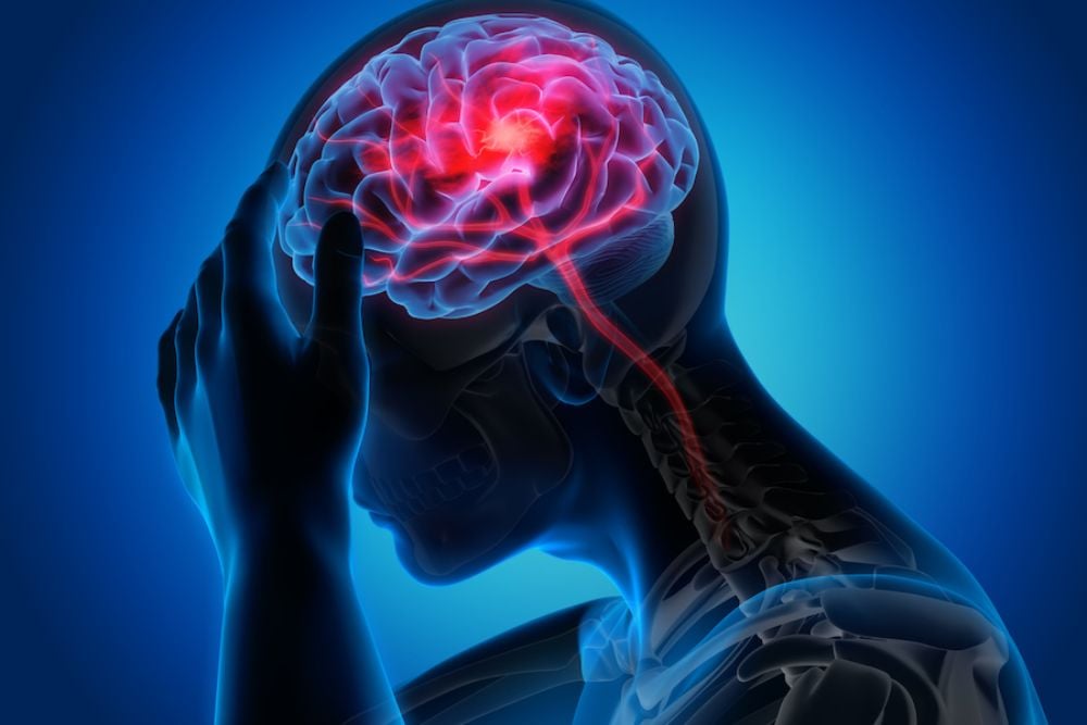 Ini Golongan Darah yang Paling Berisiko Kena Stroke: Temuan Penting untuk Kesehatan Anda